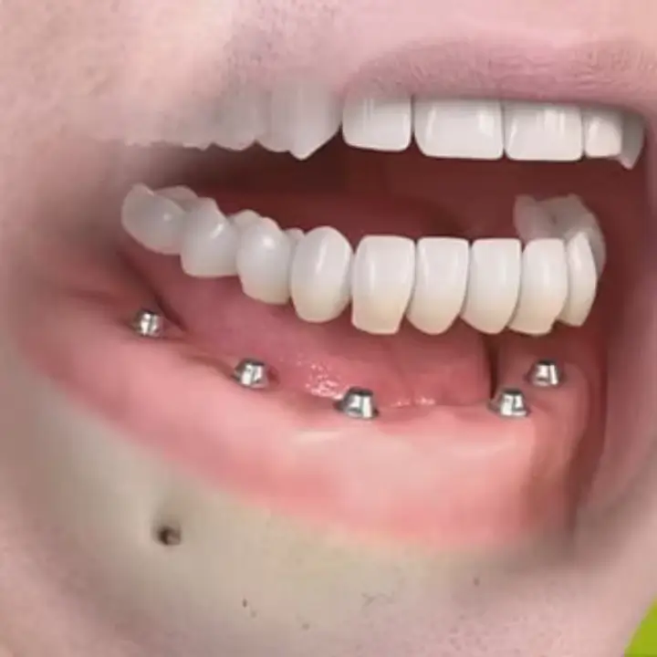 implante-dra-sandra-miranda