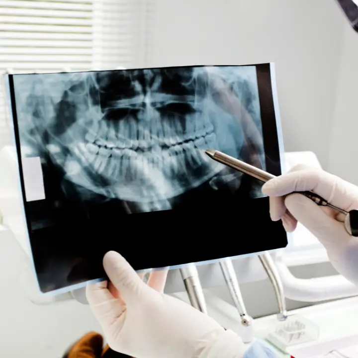 cirurgia-bucomaxilofacial